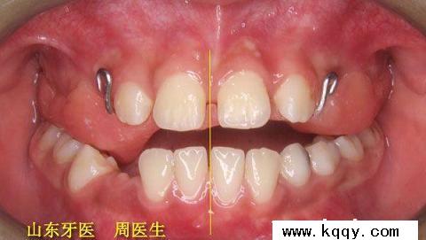 湖南省中职学校专业教师培训启动‘3377体育’(图3)